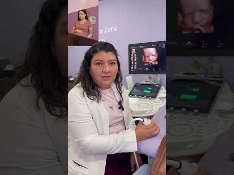 ¿Qué se revisa en el primer trimestre de embarazo? | Reina Madre #embarazo #ultrasonido