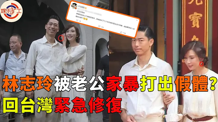 秘密藏不住？曝林志玲被老公家暴致假体飞出，紧急回台做修复手术，黑泽良平真实形象大跌眼镜 #林志玲 #娱乐矿工 #黑泽良平 #akira - 天天要闻