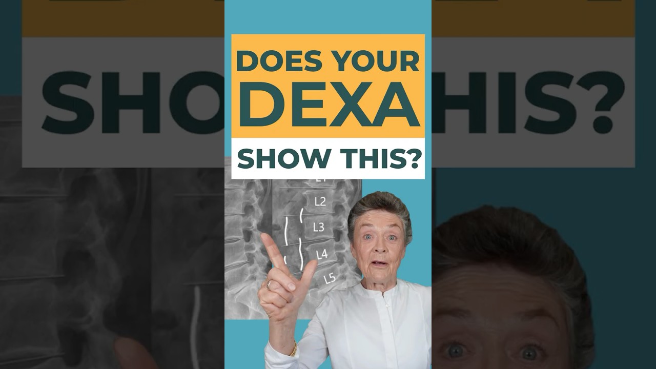 Показывает ли ваш DEXA признаки ЭТОГО?