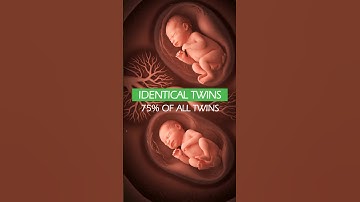 Development of Monochorionic Diamniotic IDENTICAL TWINS ❤️ #shorts #pregnancy #twins