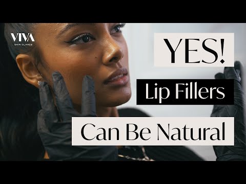 Video: Kunnen lipfillers er ooit natuurlijk uitzien?