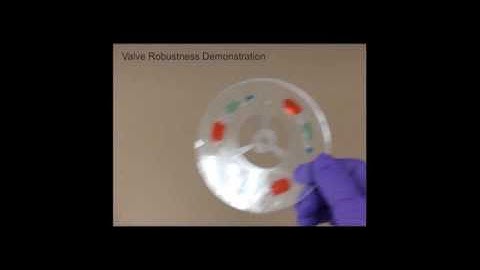 A field-deployable mobile molecular diagnostic system for malaria at the point of need