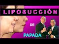 LIPOPAPADA / LIPECTOMÍA SUBMENTAL CERVICOPLASTÍA LIPOSUCCIÓN DE PAPADA