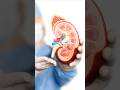 சிறுநீரக செயலிழப்பு அறிகுறிகள்,10 Symptoms of kidney failure | signs of kidney failure Tamil #shorts