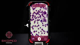 Skoped Micro App Photo/Video Feature Walkthrough W/ Dr. Cade Wilson screenshot 3