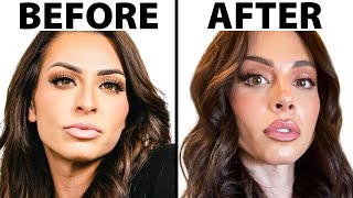 Incredible Nose Job Transformation | Plastic Surgeon Reacts