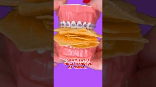 HOW TO EAT CHIPS WITH BRACES ON 👀 ORTHODONTIST REACTS #shorts