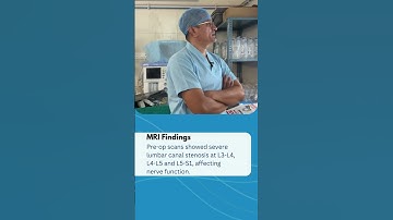 Case Study : Lumbar Spinal Stenosis