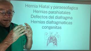 Hernia hiatal y paraesofágica. Hernias congénitas  de Hiss Boshdaleck y larrey  Morgagni