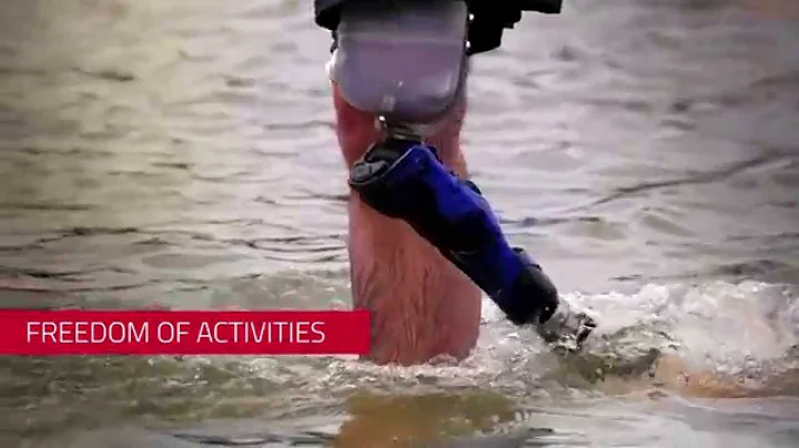 Plié 3 Microprocessor Controlled Knee (Product Video)