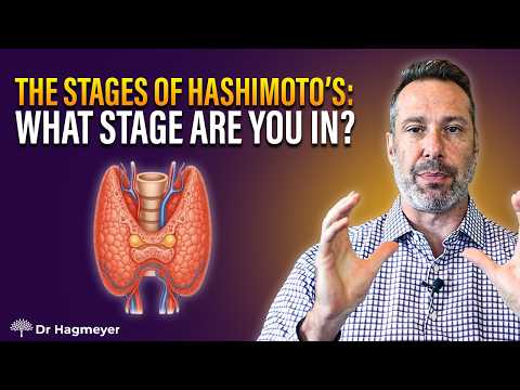 Stages of Hashimotos thumbnail