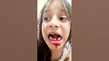 خلع سن ليان بالخيط و ايباد أسهل مما تتوقع 