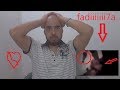قضيةاغتصاب حنان بالقراعي و طفل بني محمد مكناس