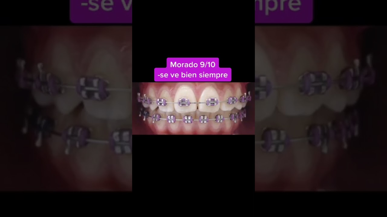 LIGAS DE BRACKETS shorts YouTube