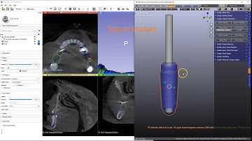 B4D Guide Update
