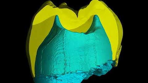 Fossil human tooth structure in 3D