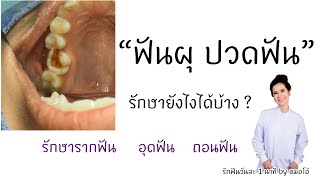 #ฟันผุ #รักษา #ปวดฟัน ฟันผุรักษายังไง อุดฟัน ถอนฟัน รักษารากฟันได้มั๊ย/รักฟันวันละ1นาที by หมอโอ๋