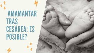 AMAMANTAR TRAS CESÁREA: ES POSIBLE? y el papel de una doula