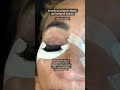DON'T Let This Happen To You! Removing Bad Cluster Lashes | Oddly Satisfying Lash Removal #Shorts