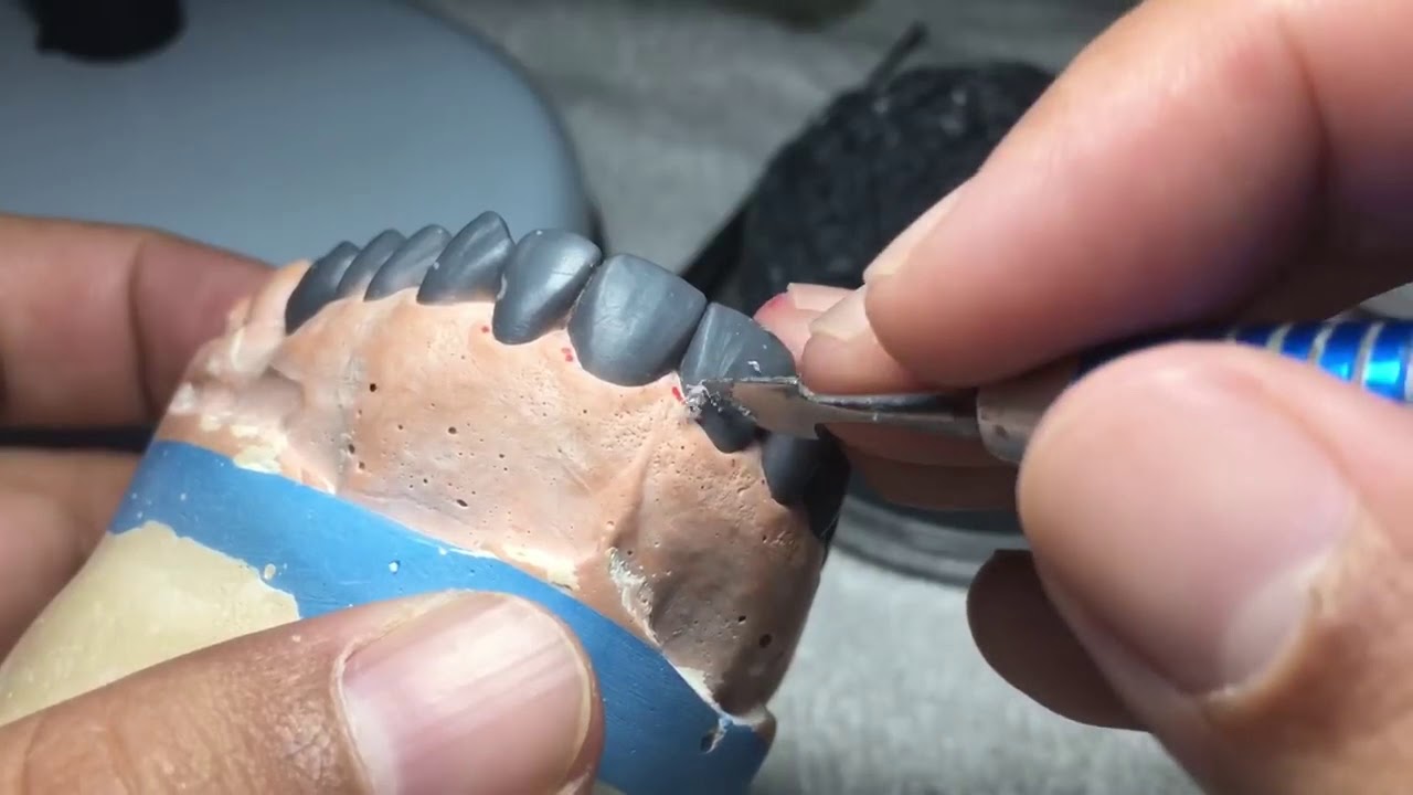 كيف تصبح فني اسنان مبدع
التحسينات واللمسات الأخيرة المطلوبة في تشميع الأسنان