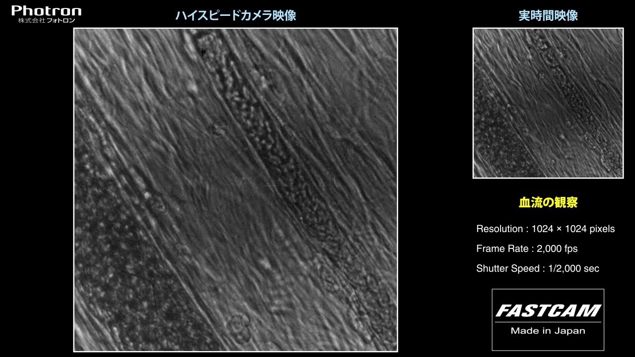高速度カメラで撮影した 血流の観察 高速度カメラで撮影した 血流の観察