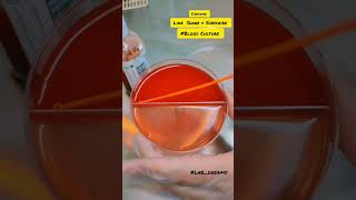 Blood culture ? viralvideo viralshort like bloodline share laboratory lab