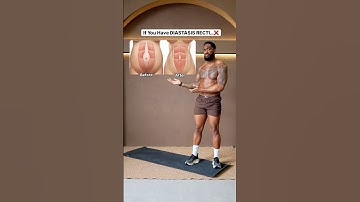 If You Have DIASTASIS RECTI… (Do This!)✅