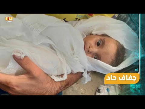 دون حصار طفلة سورية تموت بسبب نقص التغذية في مخيم البل شمال حلب