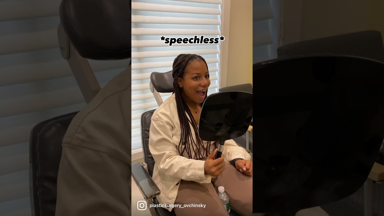 Nose Cast Removal Reaction, & Review!