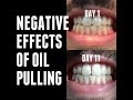 OIL PULLING EXPERIMENTS Negative Side Effects Day 11