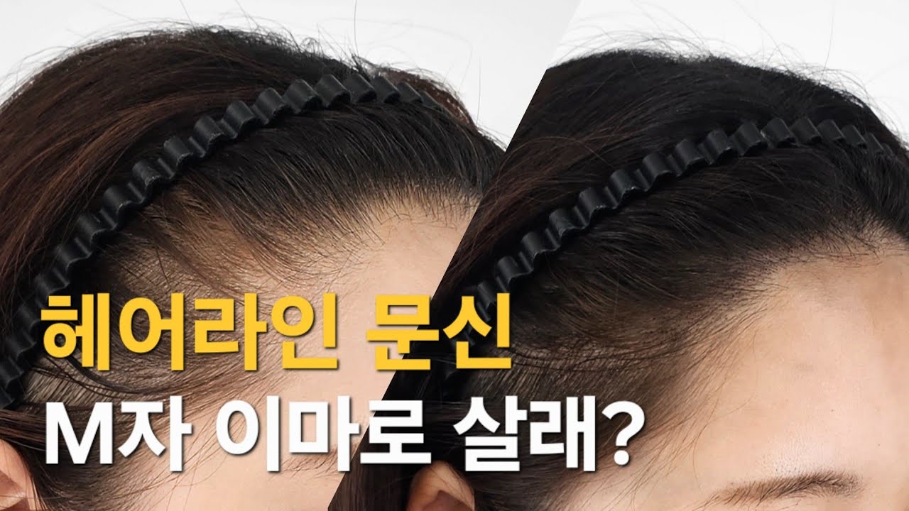 헤어라인 문신 가격부터 후기까지