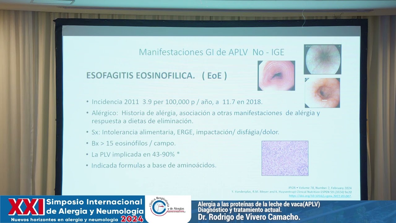 Alergia a las proteínas de la leche de vaca APLV Diagnóstico y tratamiento actual. - Dr. Rodrigo