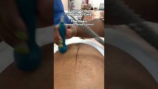 Baby Heartbeat vs Umbilical Cord Sounds - Midwife Appointment… have you heard the difference before?