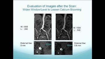 The Nuances of the Imaging for Procedural Planning - John Lesser, MD