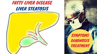 Fatty Liver Disease | Liver Steatosis