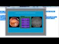 matlab mini projects image processing | matlab mini thesis image processing