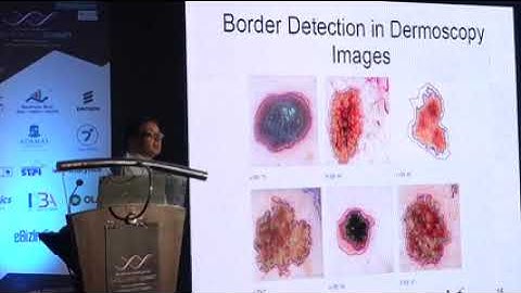 Density based Clustering  Dbscan and Optics