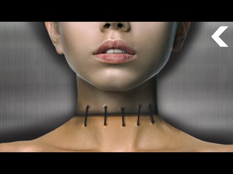 Video: Human Head Transplant Will Be A Reality By 2030 - Alternative View