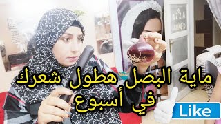 ماء البصل يساعد على انبات الشعر ويعالج الصلع ويمنع التساقط