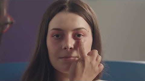 MRCP PACES Station 1: Respiratory section (pathological condition)