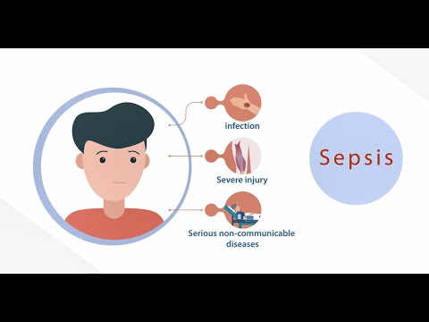 Video: Zou bloedonderzoek sepsis aantonen?
