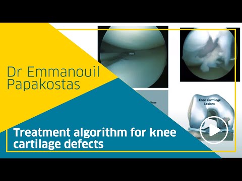 Treatment algorithm for knee cartilage defects, Dr Emmanouil Papakostas