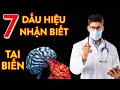 7 Dấu Hiệu Nhận Biết CƠN TAI BIẾN MẠCH MÁU NÃO Sắp Đến và “THỜI GIAN VÀNG” cứu sống người bệnh!!!