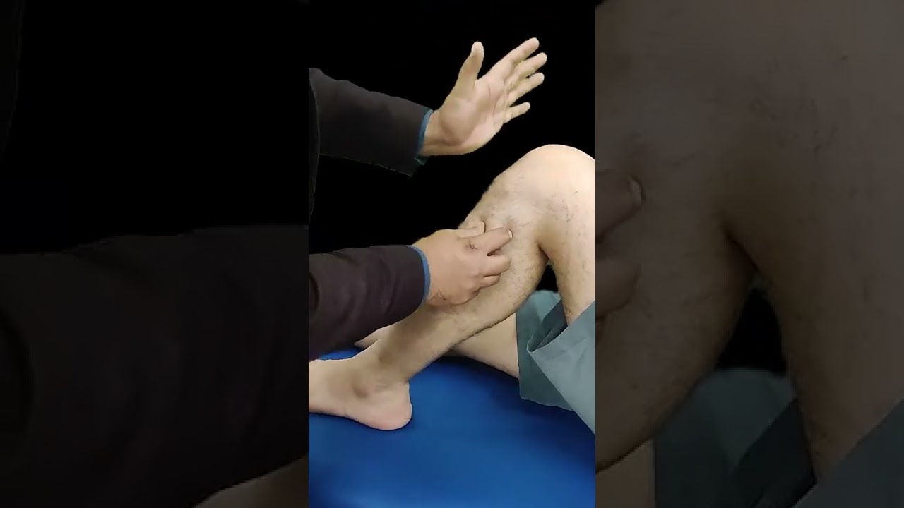 FIBULA MOBILIZATION TECHNIQUE