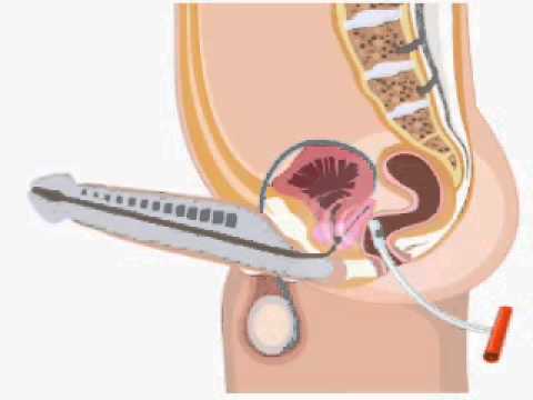 How To Have A Prostate Orgasm 79