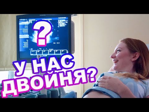 VLOG: У НАС БУДЕТ ДВОЙНЯ? ПЕРВОЕ УЗИ! 23.12.17
