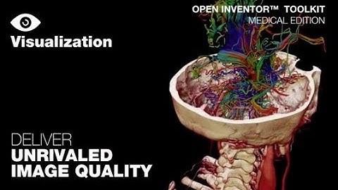 Open Inventor Toolkit Medical Edition Visualization