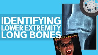 Long Bones of the Leg (Made Super Easy)