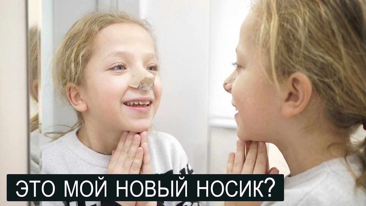 ДЕВОЧКА ПЕРВЫЙ РАЗ УВИДЕЛА СВОЙ НОВЫЙ НОСИК.
