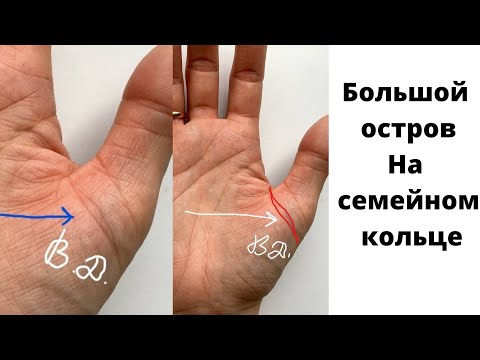 Василиса Дождь. Остров на семейном кольце. Хиромантия